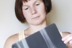 Uno de los beneficios de pilates es reducir el riesgo de osteoporosis.