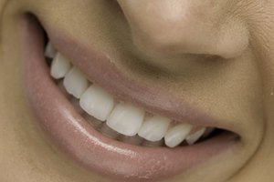 Éstas se pueden diseñar para que sean un poco más anchas que tus dientes naturales y así llenar el vacío.