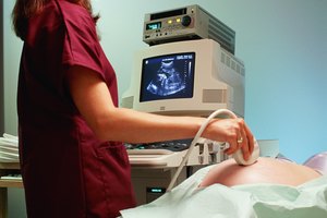 Doctor performing ultrasound exam on pregnant woman