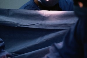 La intervención quirúrgica puede ser necesaria para tratar las hemorroides sintomáticas.