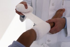 Las heridas drenan para eliminar el pus y la sangre.
