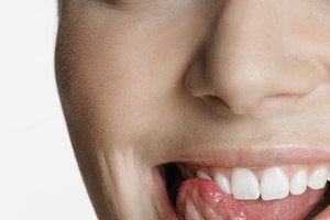 La mayoría de estos productos pueden ofrecer meses o incluso años de alivio para la sensibilidad dental.