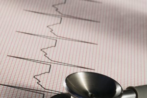 Un electrocardiograma (EKG) puede utilizarse para determinar la causa de una frecuencia cardíaca baja.