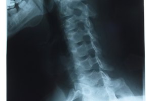 La alineación del cuello no se correlaciona con el dolor y los síntomas clínicos.