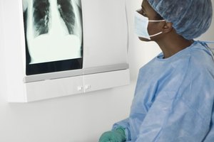 Las tomografías computarizadas se usan para diagnosticar y controlar el cáncer de pulmón.