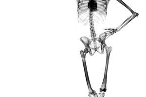 Tus huesos componen parte de tu masa corporal magra.