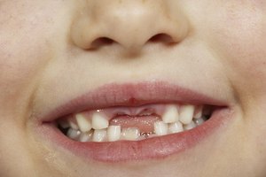 Aunque los padres crean el mito del hada de los dientes por amor, eventualmente tienes que admitir la verdad.