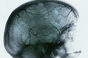 El paciente con Parkinson cuenta con alternativas para mejorar su situación.