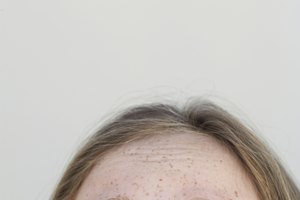 Reducir al mínimo tu exposición al sol es la mejor manera de prevenir muchos daños solares en tu piel.
