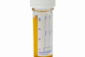 Un análisis de orina es una prueba que se lleva a cabo en el consultorio de tu médico donde se explican varios aspectos de tu salud.