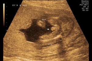 ¿Qué edad tiene mi bebé ahora?