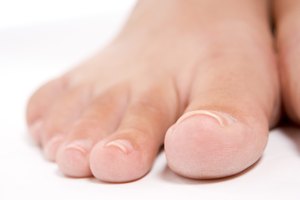 Las personas con diabetes deben revisar sus pies diariamente.