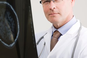 Los escáneres cerebrales muestran el tamaño y la ubicación exacta de los tumores cerebrales.