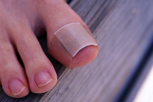 Tratar heridas en las uñas.