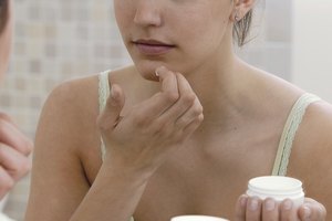 Hasta el 40% de los adolescentes requiere de un tratamiento para el acné proporcionado por un dermatólogo.