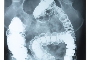 Los compuestos no aprovechables por el intestino delgado forman la materia fecal a expulsarse por el recto.
