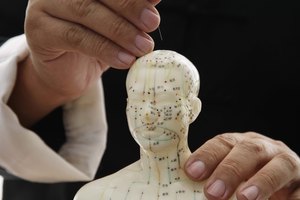 La acupuntura trata el mareo como una condición orgánica.