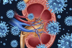 Ilustración 3D de la infección renal.