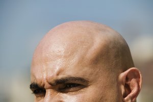 La finasterida también se ofrece bajo el nombre comercial Propecia, para el tratamiento del patrón de calvicie masculino y la pérdida del cabello.