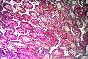 Diversos factores pueden provocar el dolor testicular.