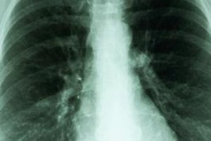 Medioimages/Photodisc/Photodisc/Getty Images Radiologists use a variety of imaging technologies, including X-ray, ultrasound and nuclear medicine.