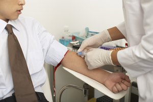 Más comúnmente, se accede a la vena cefálica en el antebrazo en lugar de la parte superior del brazo.