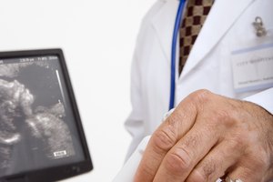 Determina el diámetro fronto-occipital de la cabeza fetal.
