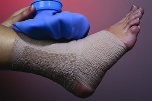El descanso, hielo, compresión y elevación ayudan a calmar el dolor y la hinchazón.