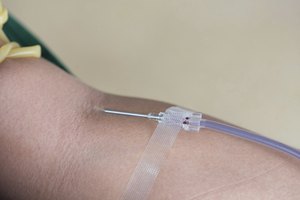 La anemia puede hacer que te sientas sin energía.