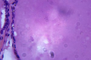 Imagen microscópica de la glándula tiroides.