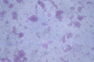 Escherichia coli.