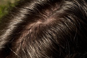 Acercamiento a cabello de hombre brillante y grasoso.
