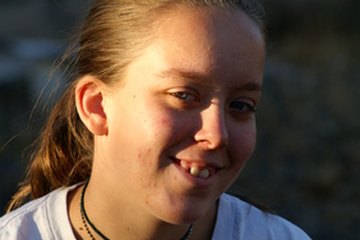 A dermatologist can treat a teenager's acne. A dermatologist can treat a teenager's acne.
