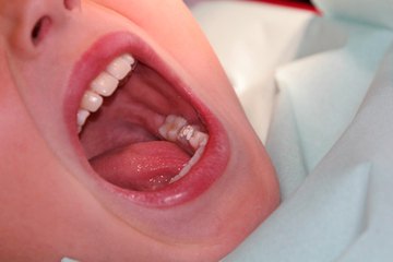Surface area of teeth helps us chew our food Surface area of teeth helps us chew our food