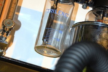 A ventilator and vaporizers are common components on an anesthesia machine. A ventilator and vaporizers are common components on an anesthesia machine.