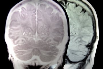 Neurology is an area in which chiropractors work on the musculoskeletal system. Neurology is an area in which chiropractors work on the musculoskeletal system.