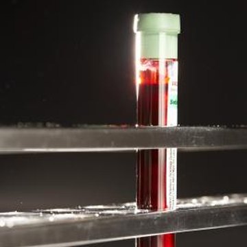 vitamin tell need deficiency definitive determine blood test way