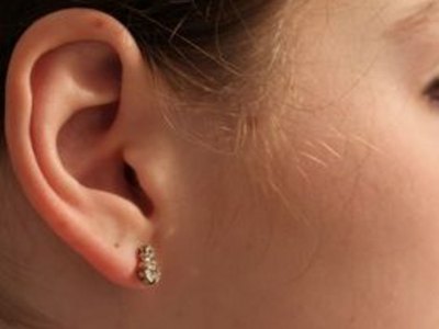 How to Clean an Ear Piercing