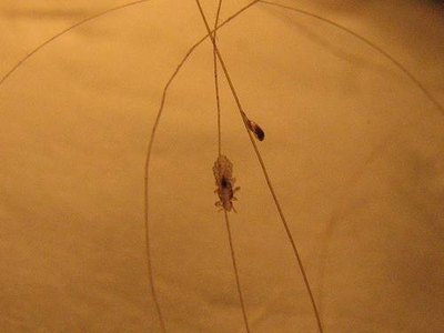 Head louse and nit
