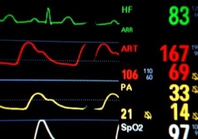 heart monitor