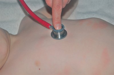 Not all ringworm rashes appear as a red rings.