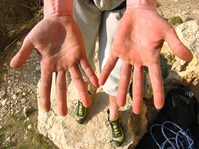 Collagen with vitamin B3 reduces blistering.