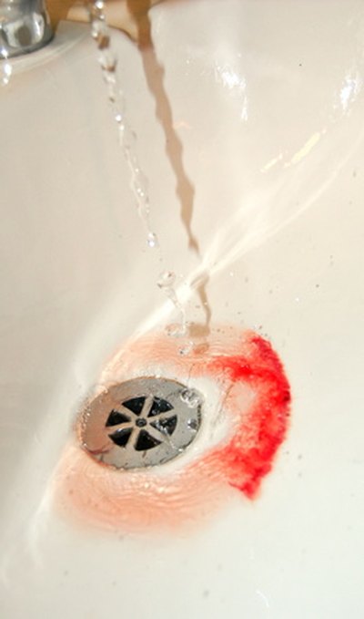 Health-care workers must follow universal precautions.