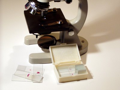 Lab workers are regularly exposed to black light radiation