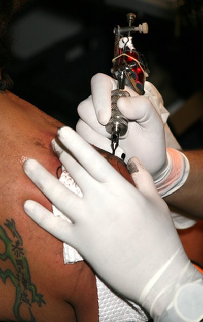 Amalgam tattoos look similar to tattoos on the skin.