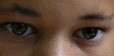 Children don't have the protective yellowing effect in their eyes.