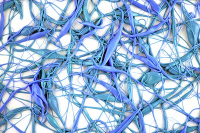 Misfiring neurons cause seizures.