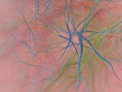 Most tortuous arteries go undetected until serious complications occur.