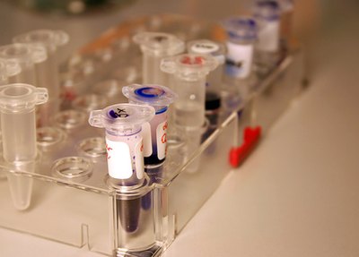 Testing for food allergies can help to pinpoint possible causes of tics.