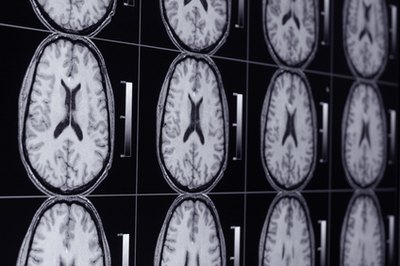 Magnetic resonance imaging (MRI), laboratory tests and other diagnostic information is captured by task-based information systems